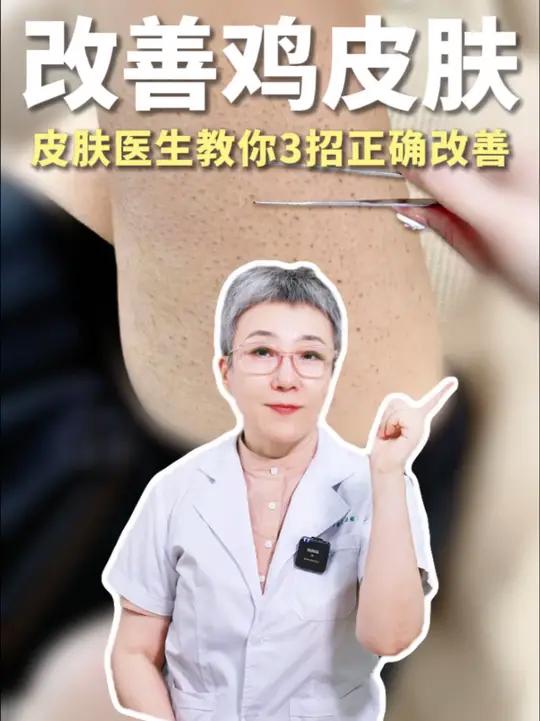 鸡皮肤别再抠了！医生教你正确处理鸡皮肤健康变美逆袭 毛周角化