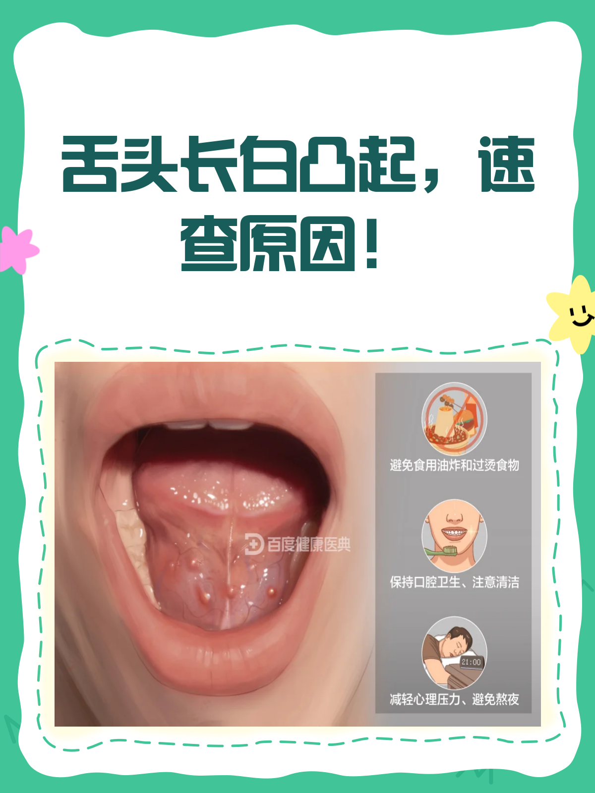 舌头上长了白色凸起?别急,先看看这篇!