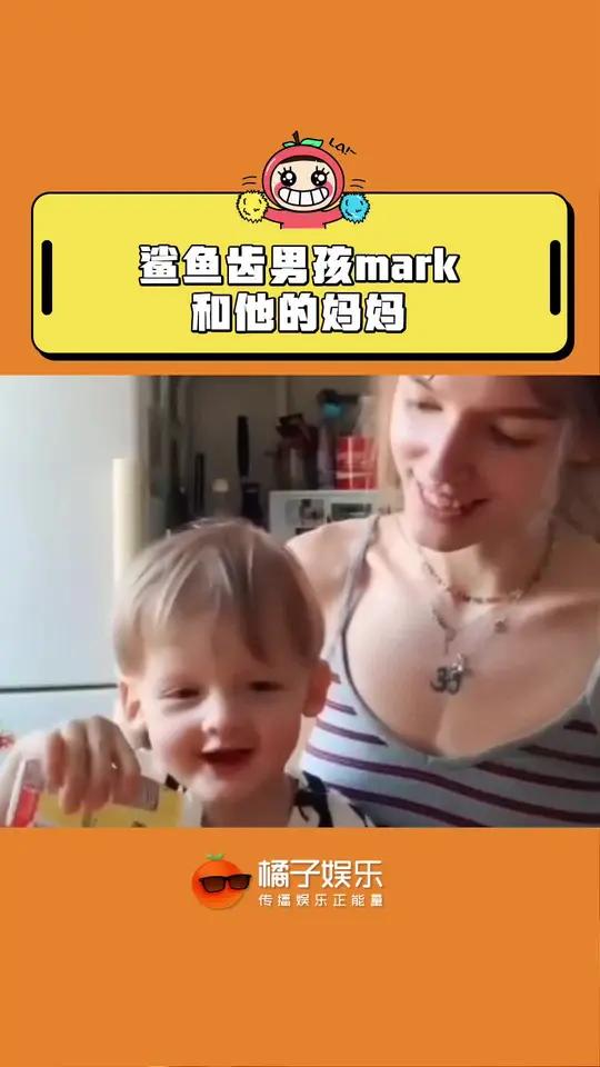 看得鼻子酸酸的,最可爱的宝贝遇到了最好的妈妈 鲨鱼齿男孩马克 母爱 感动