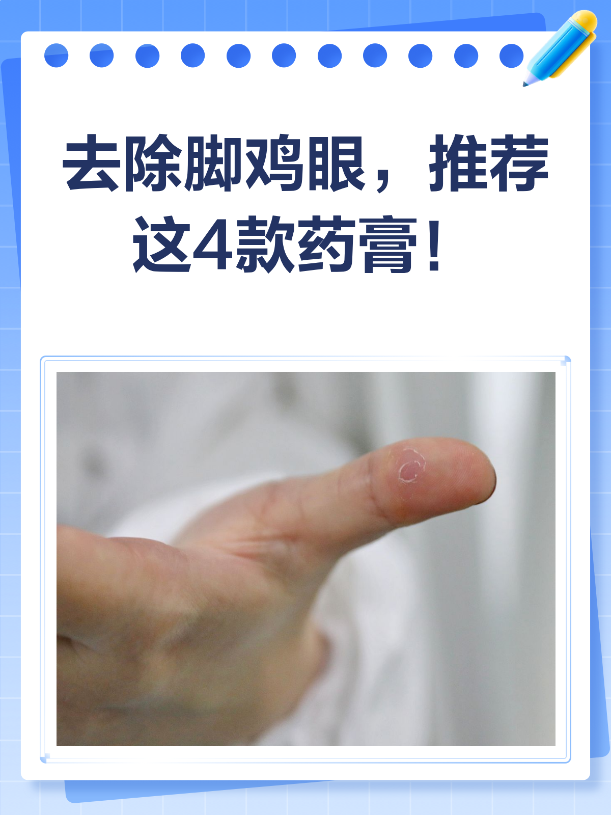 告别脚鸡眼，这些药膏来帮忙！