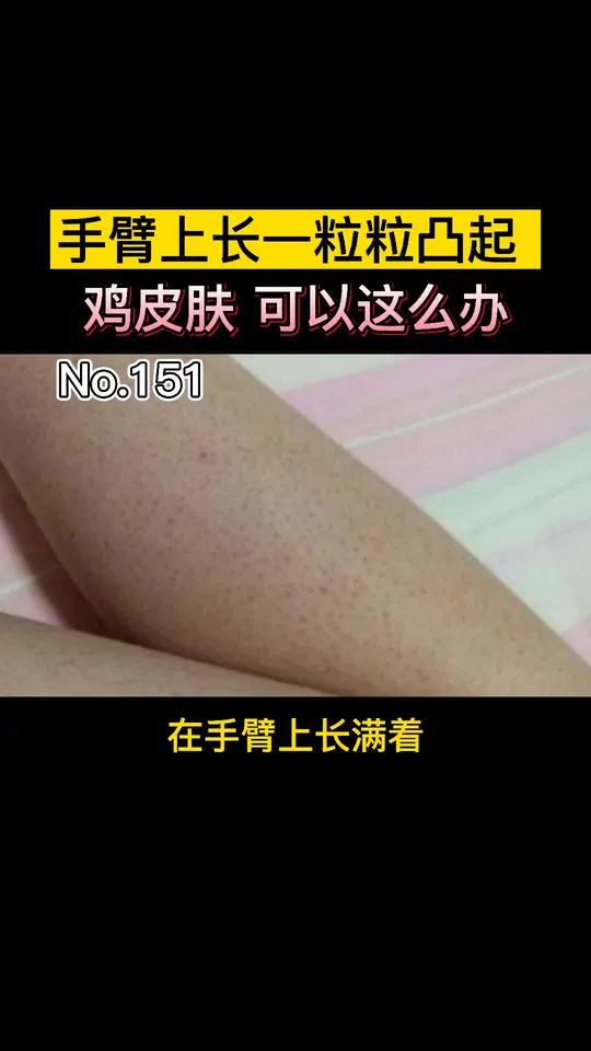 手臂长一粒粒的凸起,摸起来粗粗的,鸡皮肤我们可以这么办