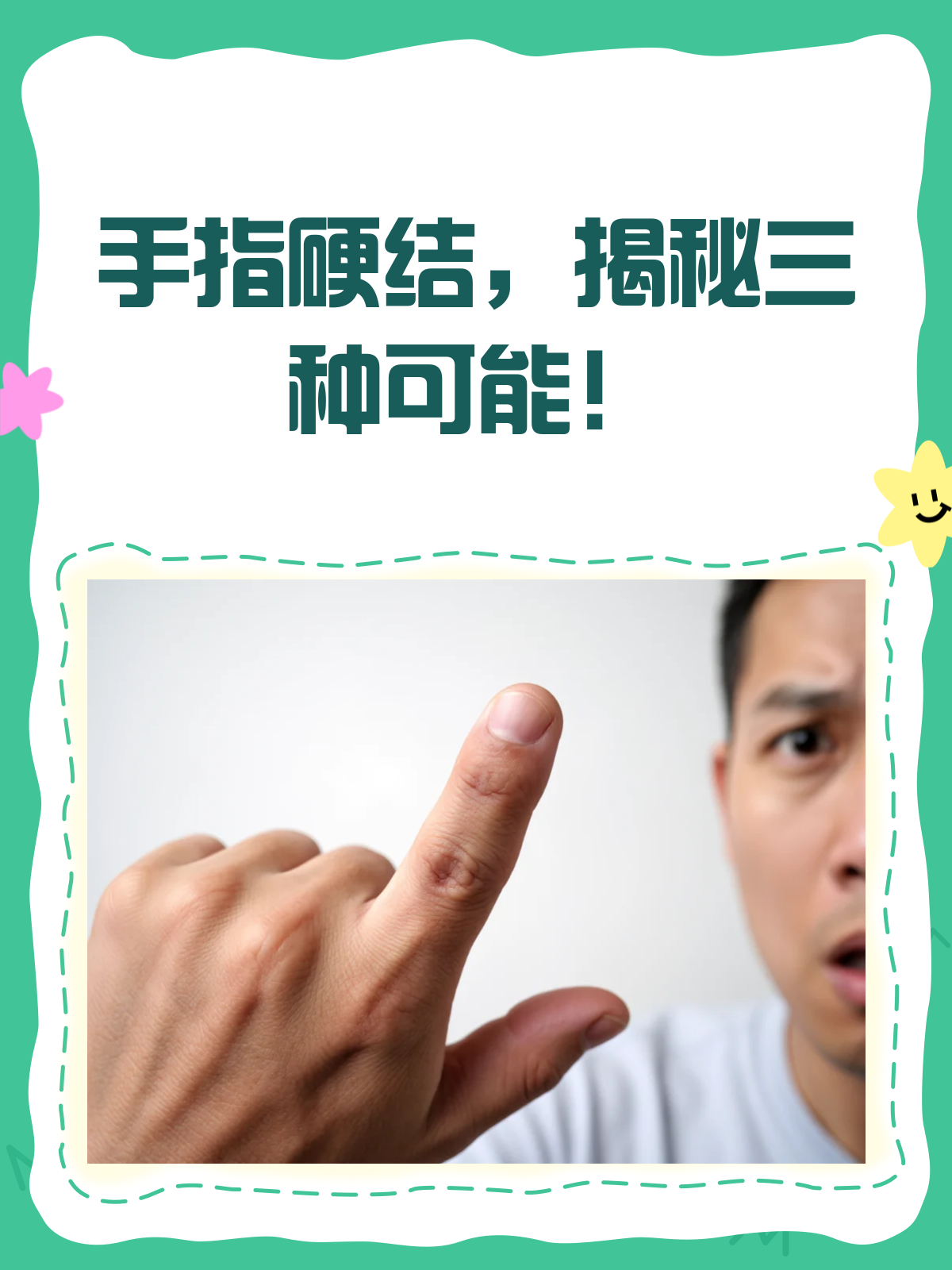 手指上长了“鸡眼”？别急，先看看这篇！