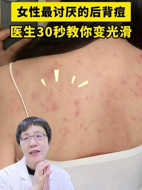 后背反复长“痘痘”,千万别乱抠,这可能是毛囊炎,当心留下难看的黑印子
