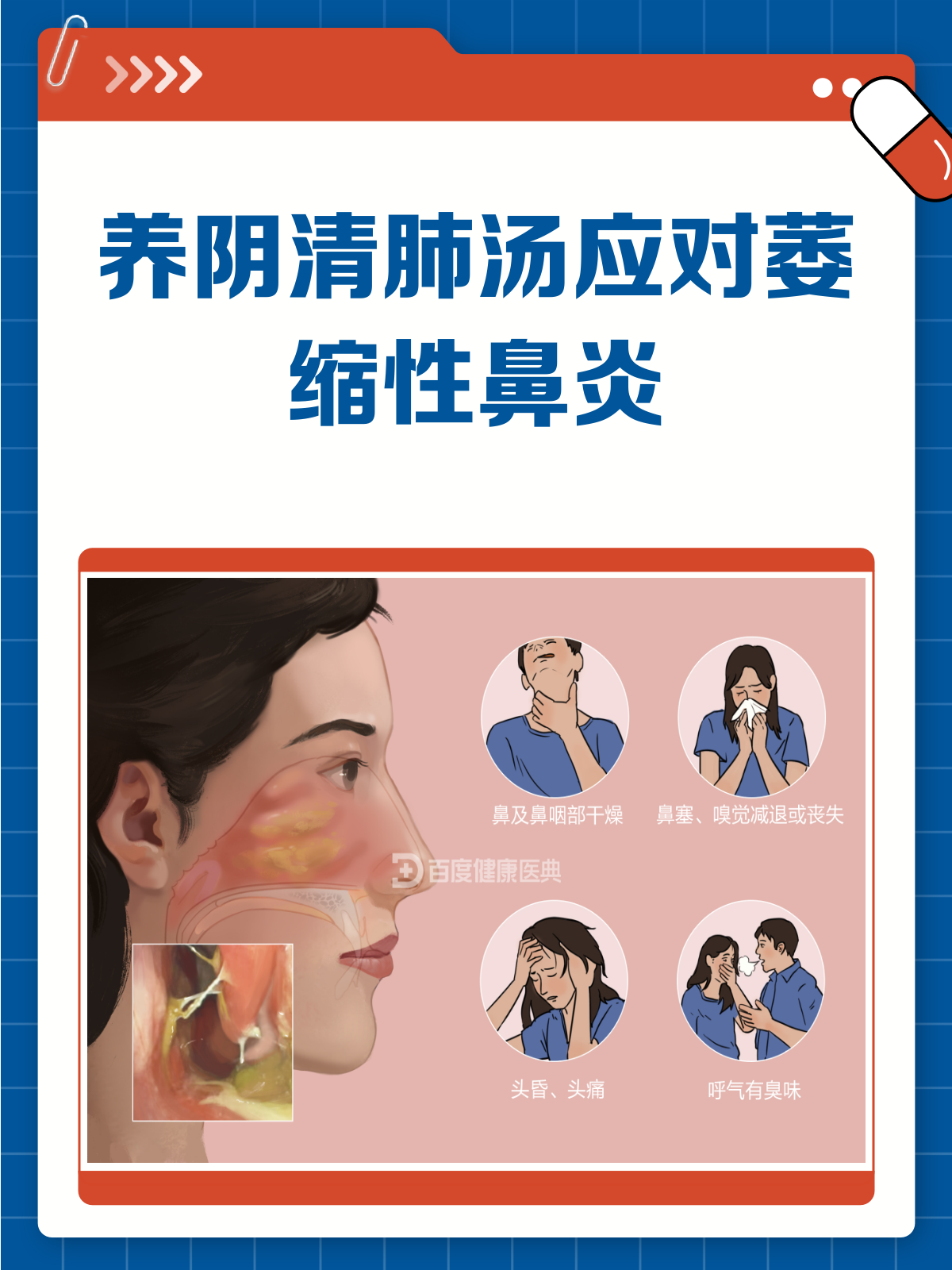 萎缩性鼻炎不用慌，养阴清肺汤来帮忙