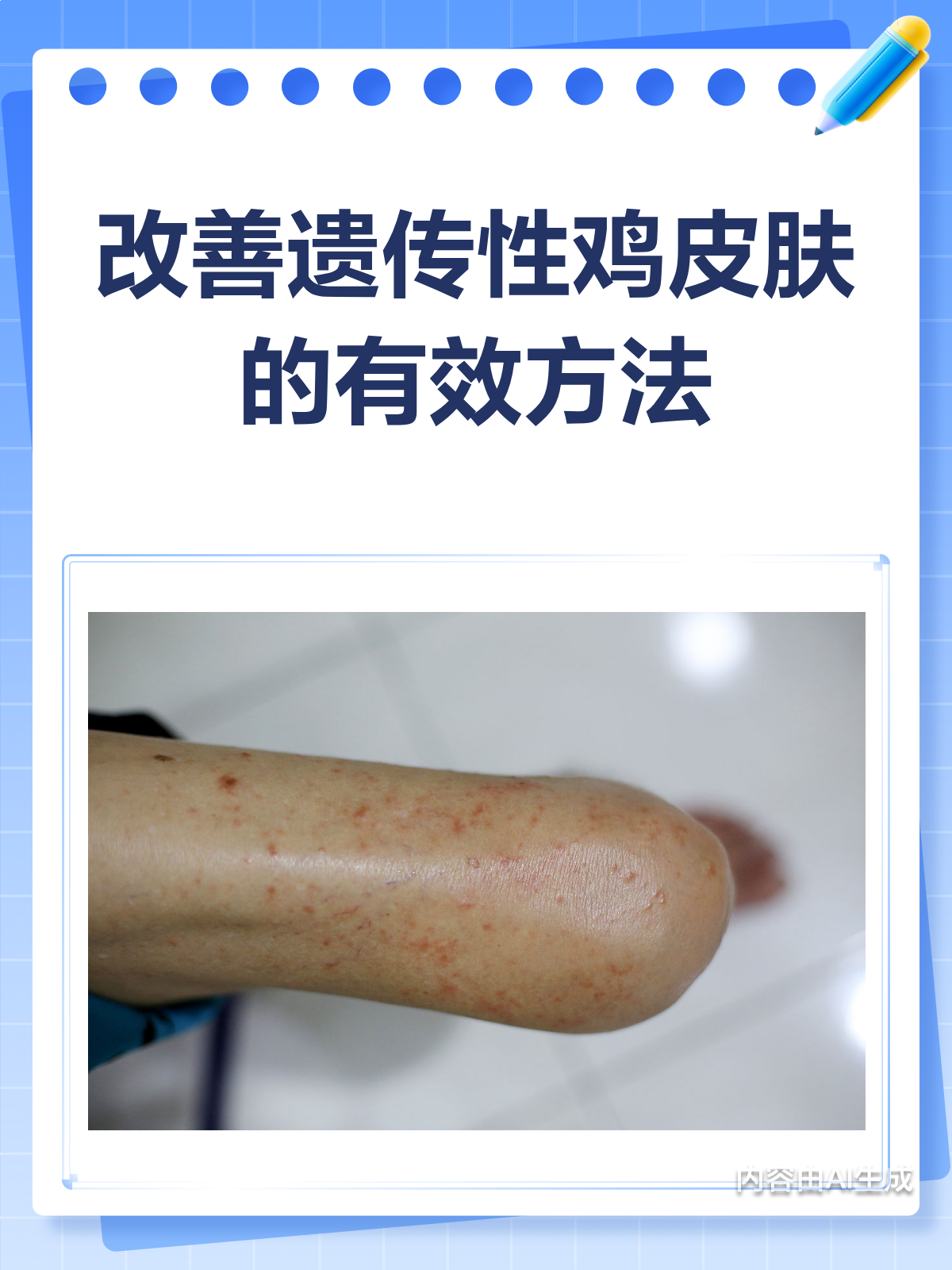 遗传性鸡皮肤,别灰心!这样改善有奇效