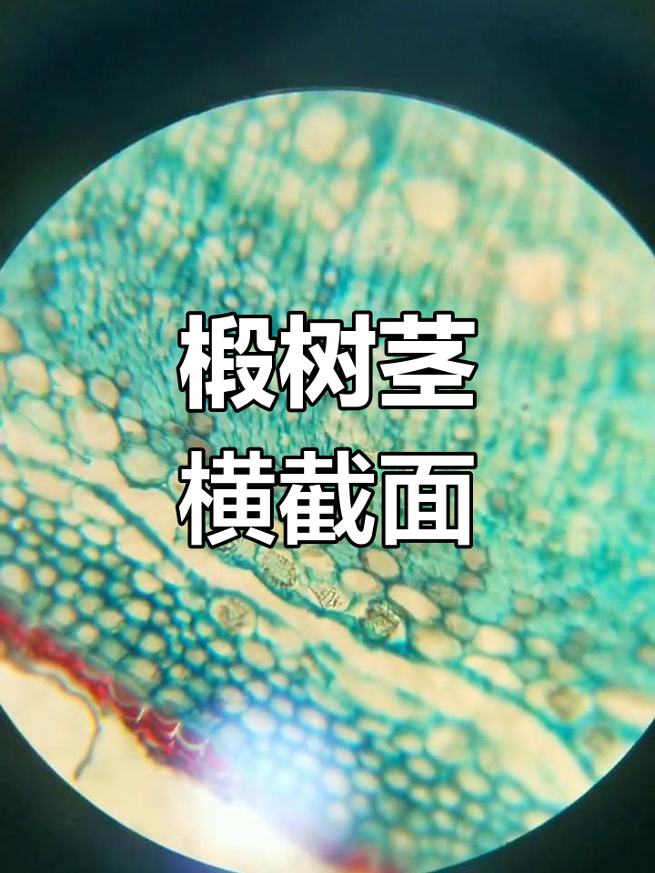椴树茎横切面显微镜观察