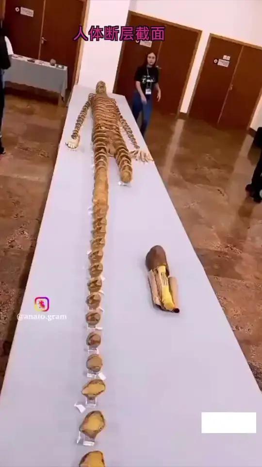 我们CT、MRI所看到的横断面,就是人体这样截面断层。感谢每一个大体老师给医学的贡献!