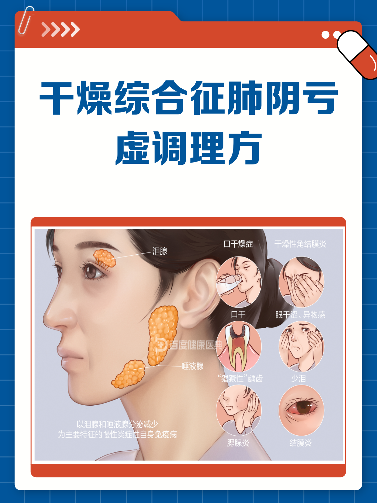 干燥综合征肺阴亏虚?养阴清肺汤来帮忙!