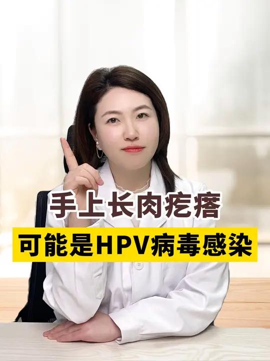 手上长这个,千万别抠,小心是hpv感染 hpv肉瘊子皮肤科普寻常疣