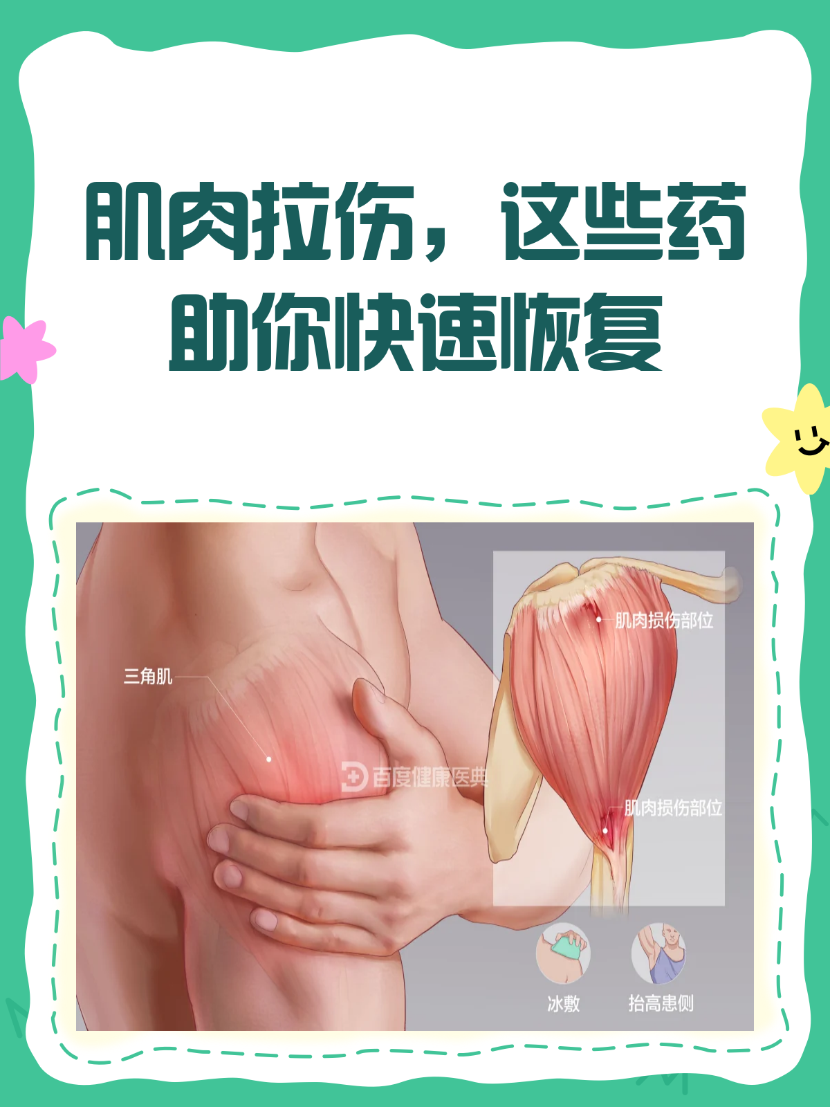 肌肉拉伤?选对药才能好得快!