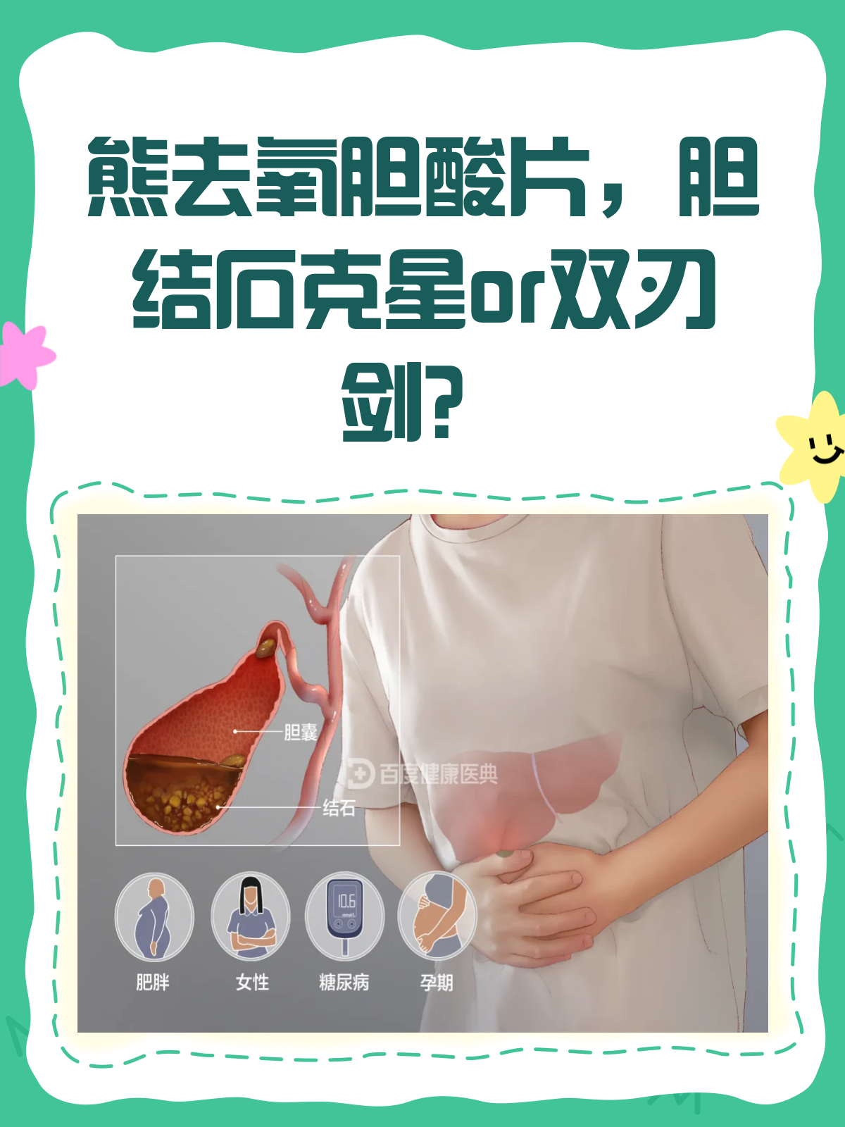 熊去氧胆酸片,胆结石的“克星”还是“双刃剑”?