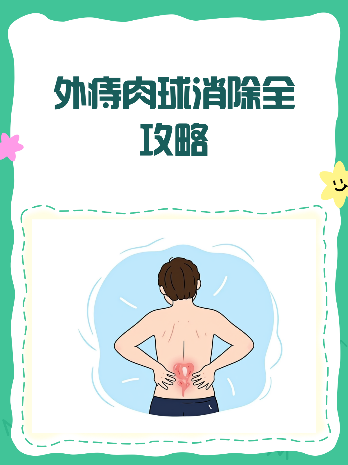 外痔肉球惹人烦?消除攻略来啦!