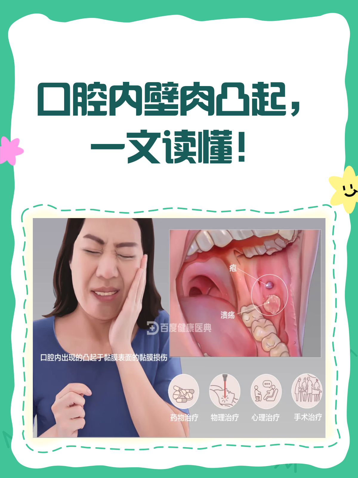 口腔内壁长肉凸起 是病吗？要怎么办？