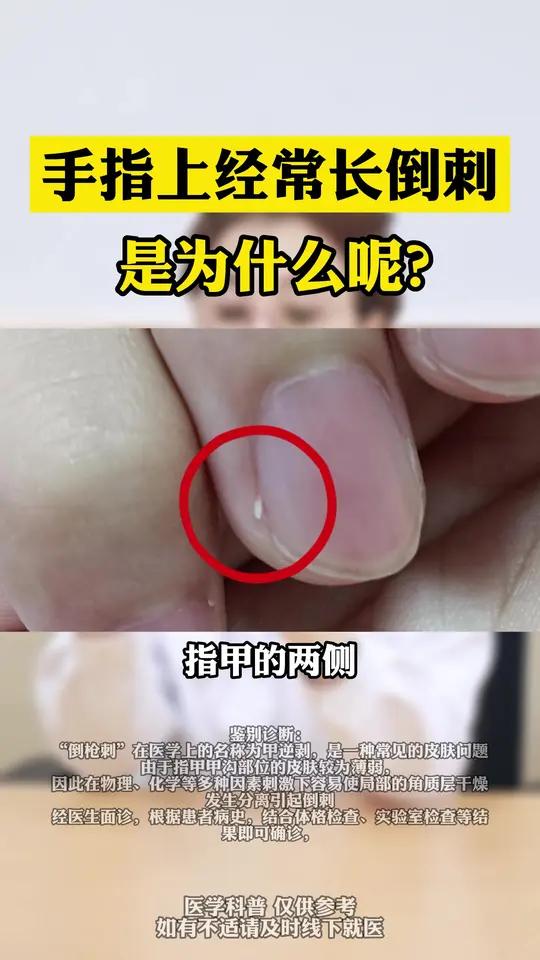 指甲两侧出现硬硬的角质,可能是你缺乏微量元素!