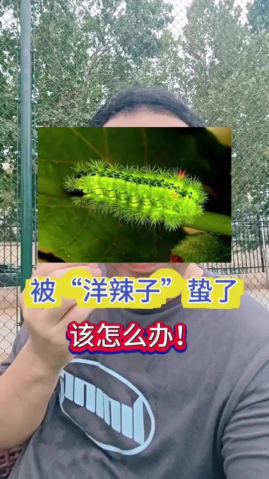 被“洋辣子”蛰了该怎么办