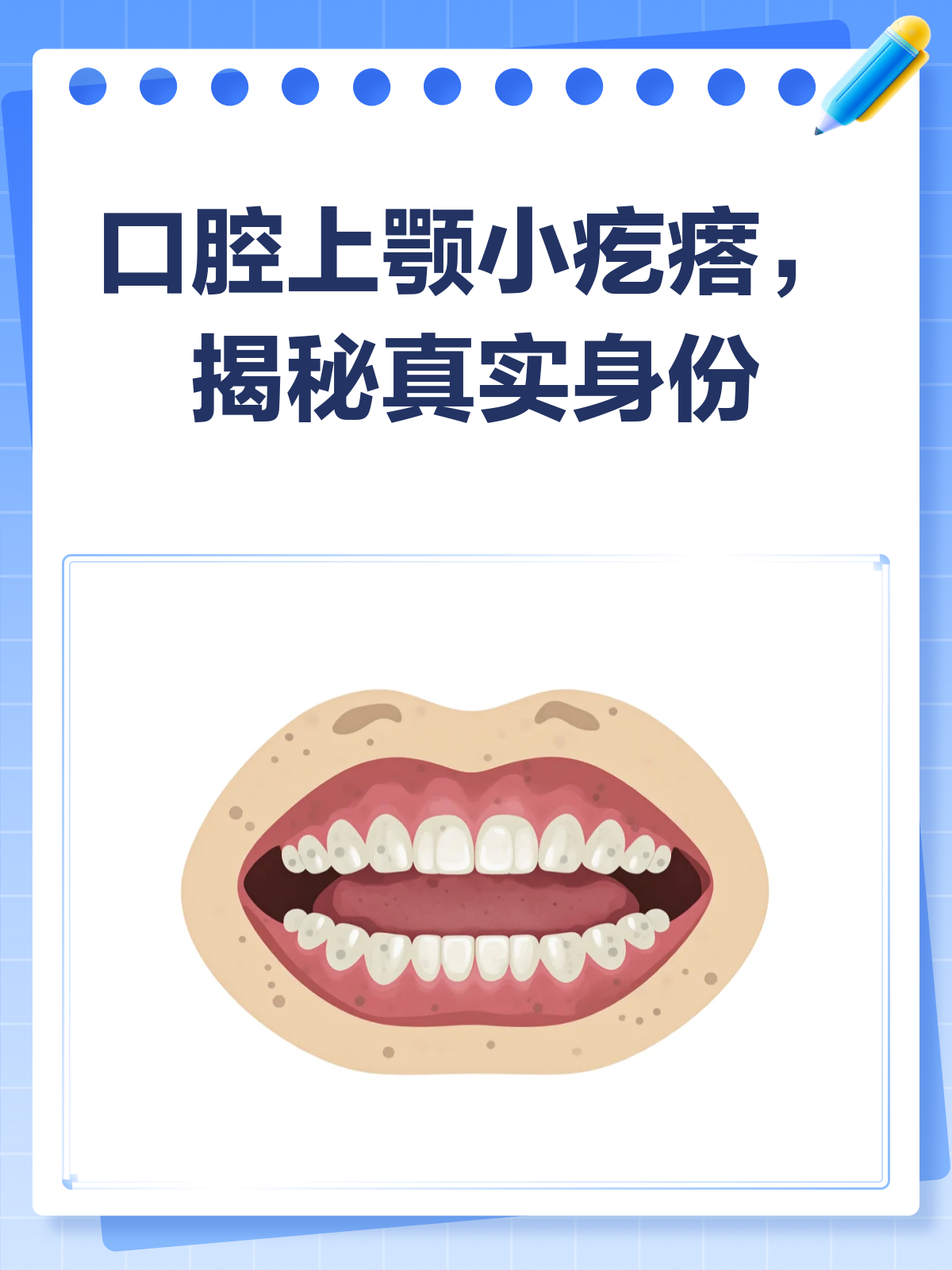 口腔上颚有小疙瘩？别急，先看看这篇！