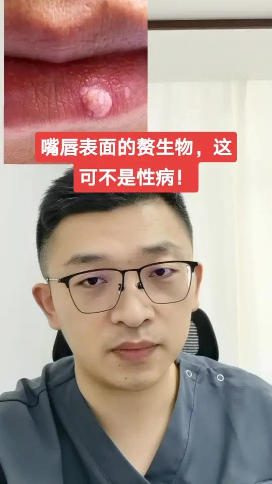 嘴唇表面的赘生物，这可不是性病！