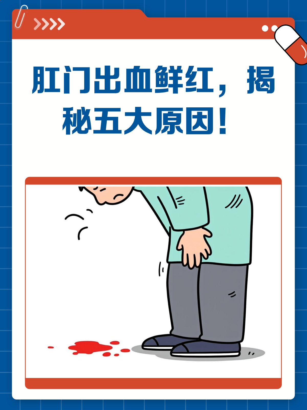 肛门出血鲜红?揭秘背后的5大原因!