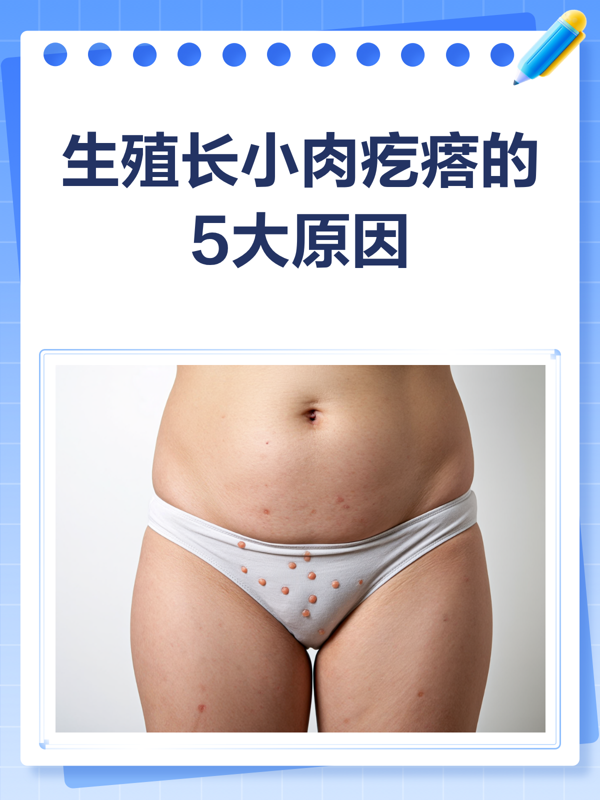 生殖上长小肉疙瘩?原因可能不止一种!