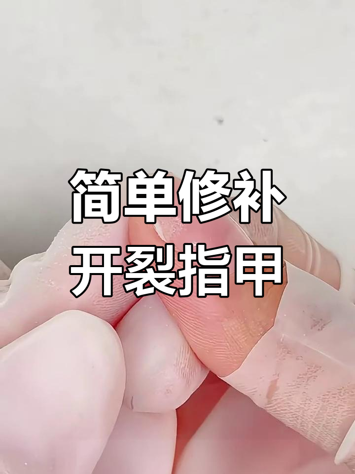 指甲裂开怎么办?0成本修复技巧大公开