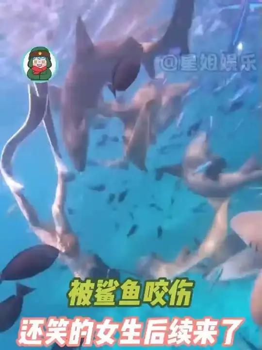 被鲨鱼咬伤还笑的女生后续来了.gyt
