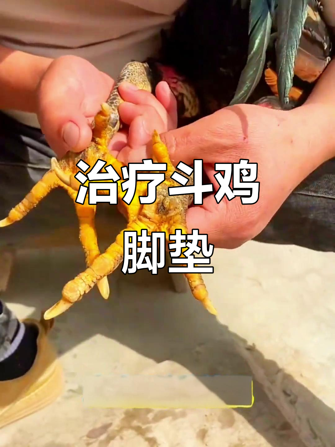 斗鸡脚肿怎么办?教你治疗脚垫和鸡眼