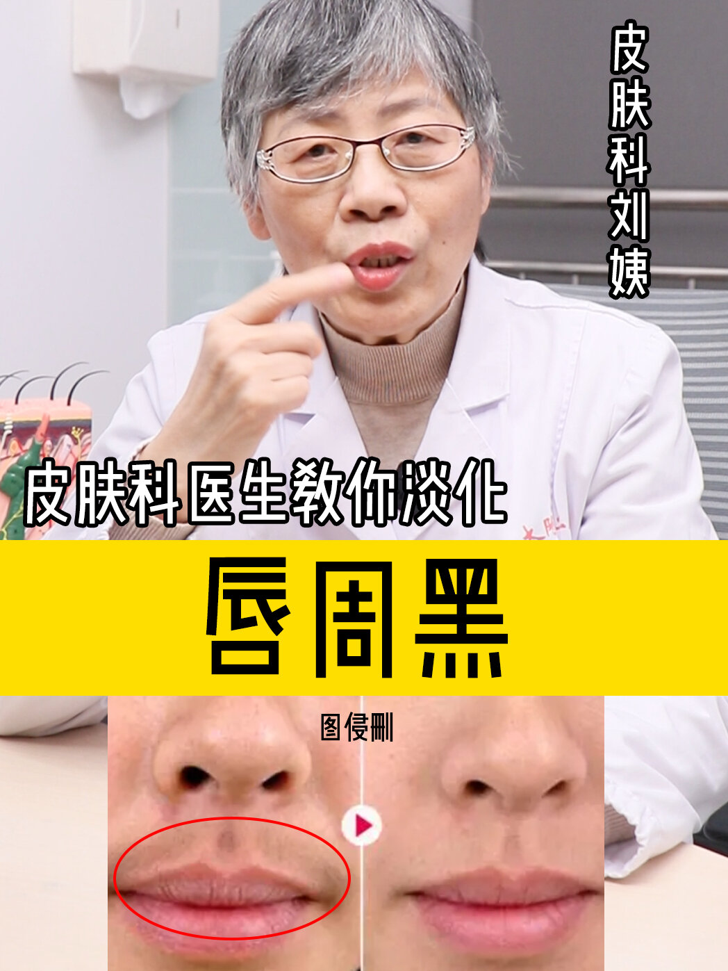 科学淡化唇周发黑暗沉,用这2步坚持涂!