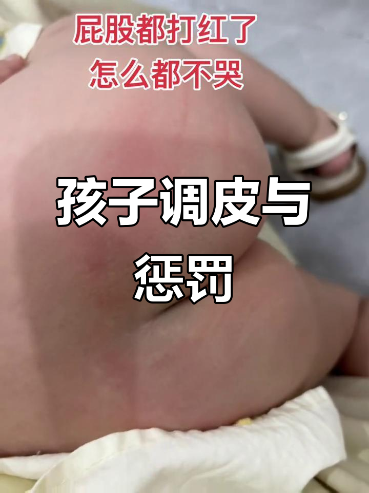 打孩子屁股,她笑嘻嘻不以为意,结果留下明显印记,心疼不已