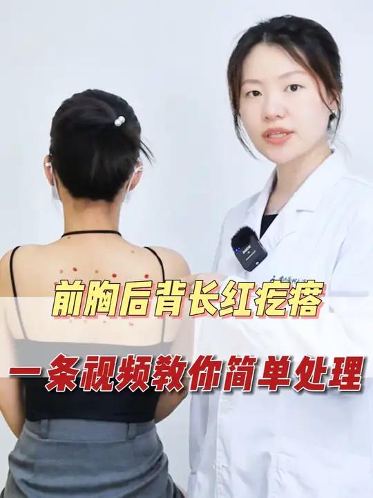 前胸后背长了很多红疙瘩,处理起来居然这么简单!