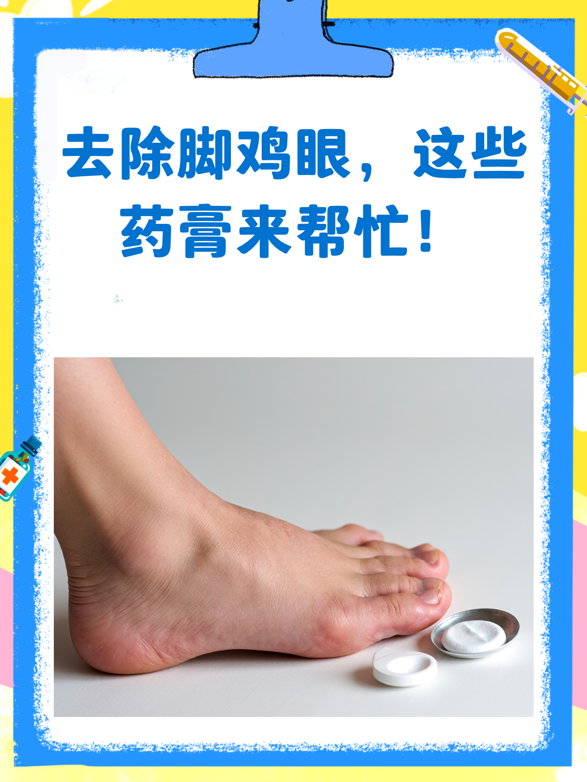 告别脚鸡眼,这些药膏来帮忙!