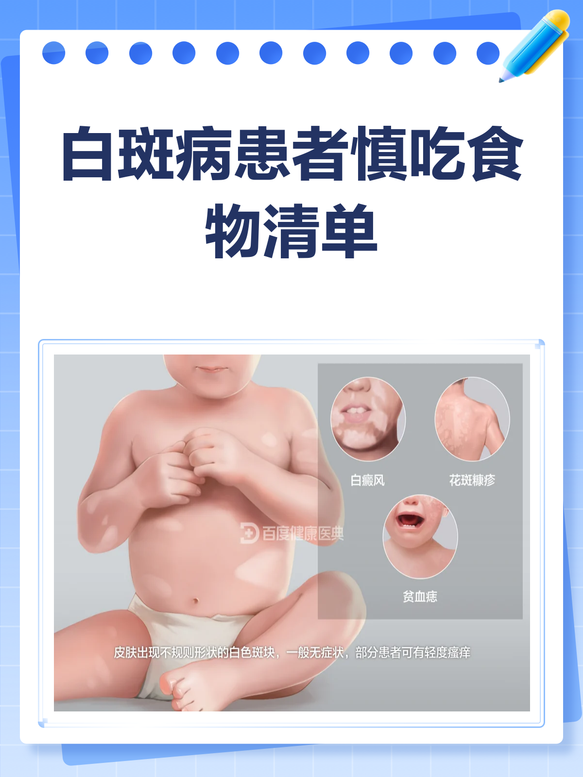 白斑病忌口清单,这些食物要慎吃!