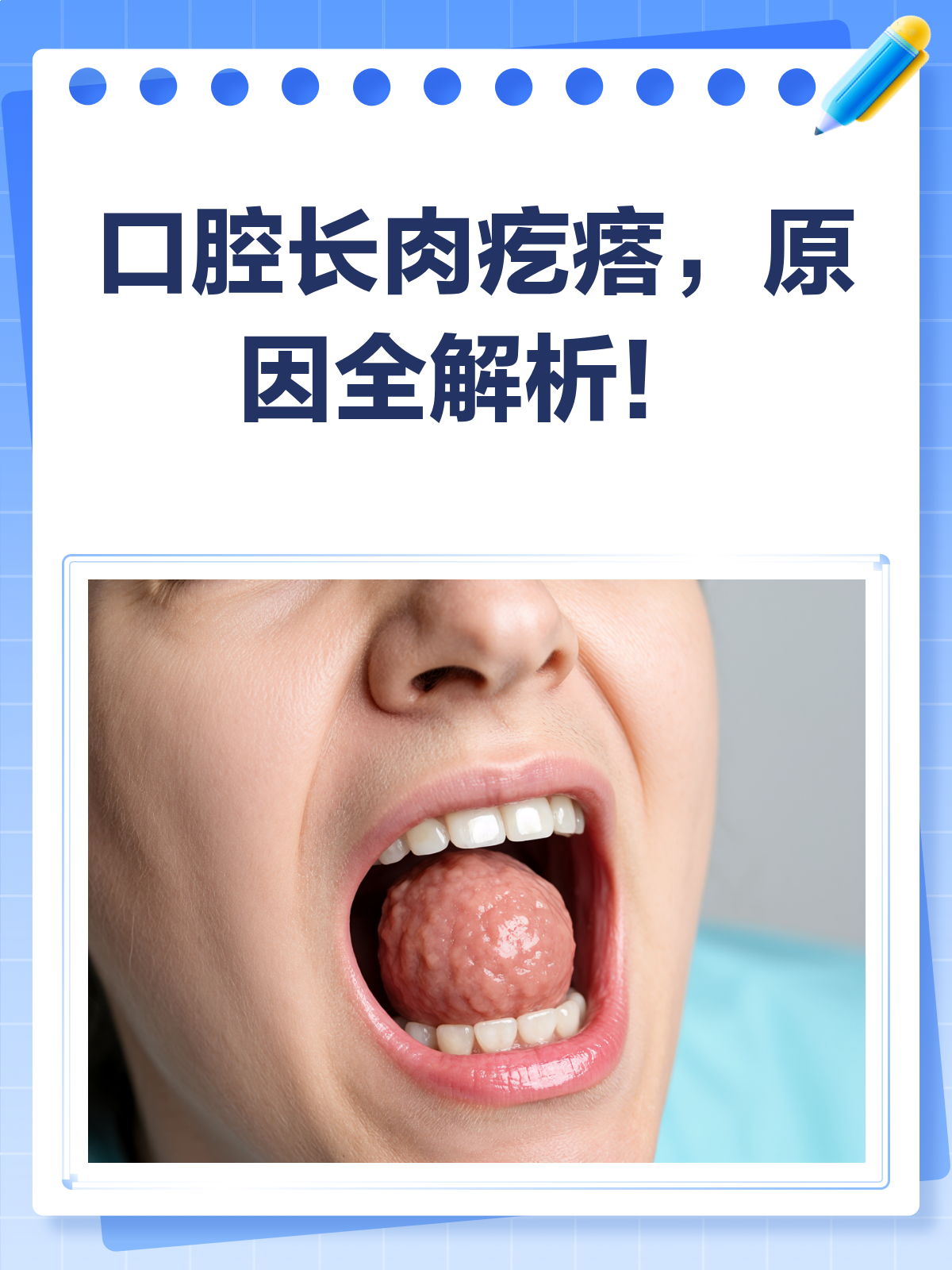 口腔里长肉疙瘩是上火还是生病了？