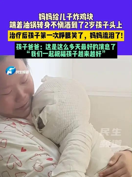 4月24日河南郑州:妈妈给儿子炸鸡块,端着油锅转身不慎洒到了2岁孩子头上,治疗后孩子第一次