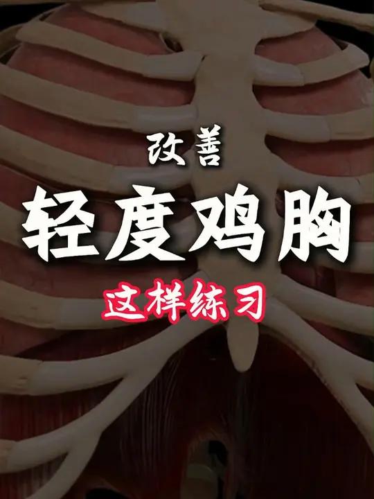 改善轻度鸡胸的三个动作,家长可以督促轻度鸡胸的小朋友练起来