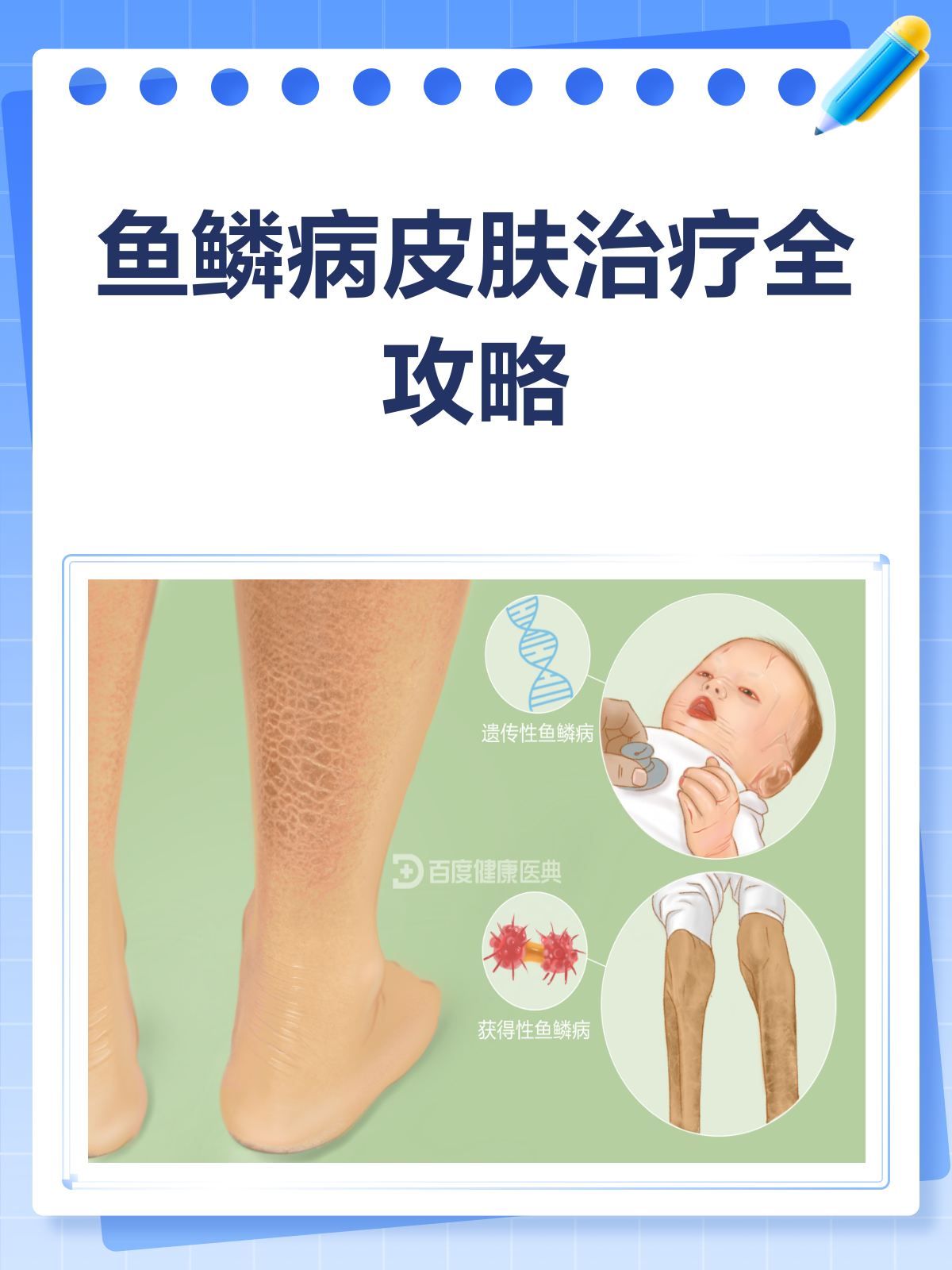 鱼鳞病皮肤，这样治才有效！