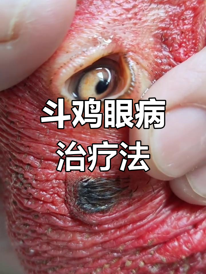 斗鸡眼病轻松治愈,一次滴药,交替使用两天见效