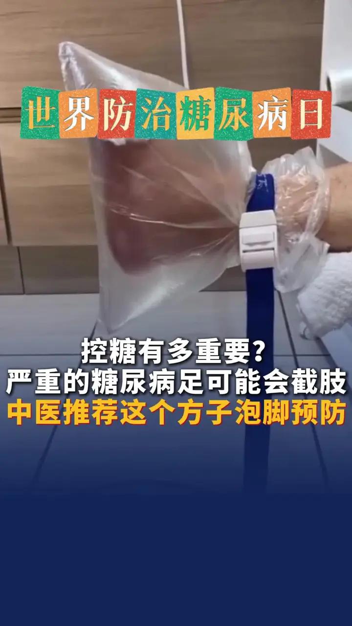 严重的糖尿病足可能会截肢!中医推荐这个方子泡脚预防。分享给家人,今天就开始控糖,泡脚!世界