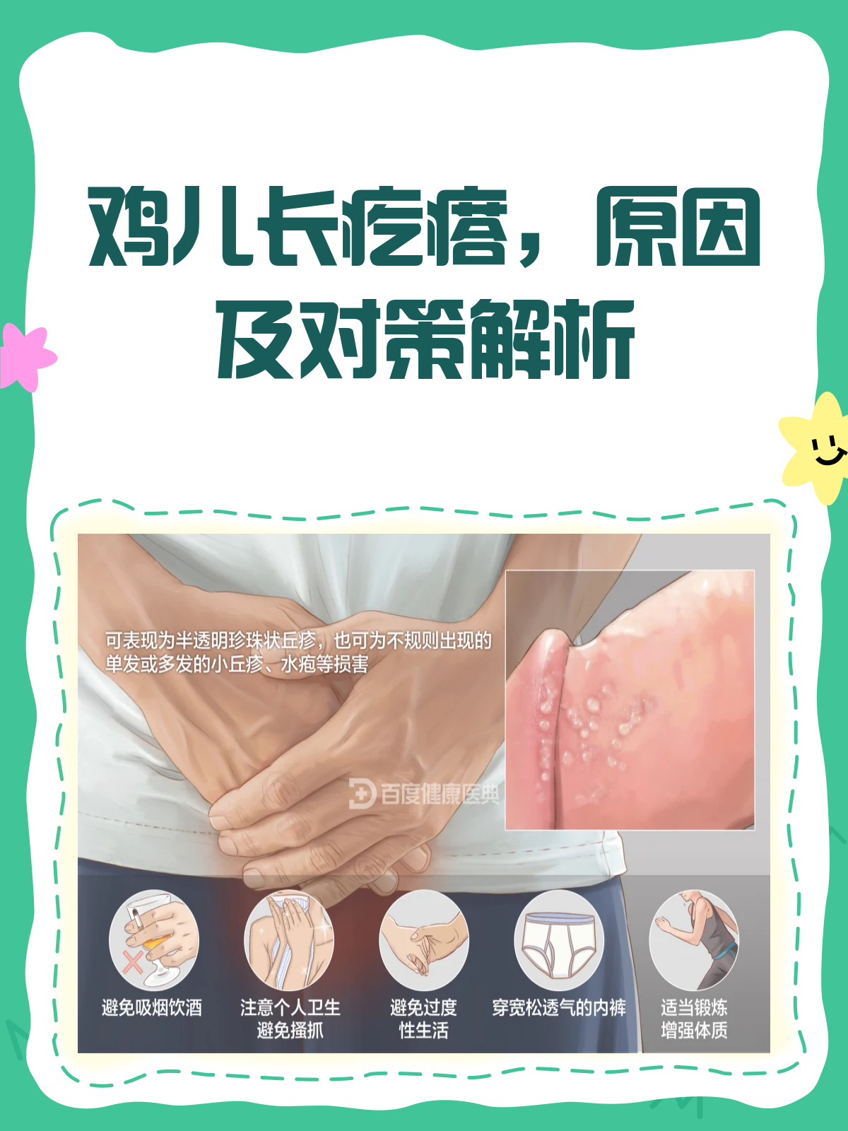 鸡儿上长了疙瘩?别急,先来看看这篇!