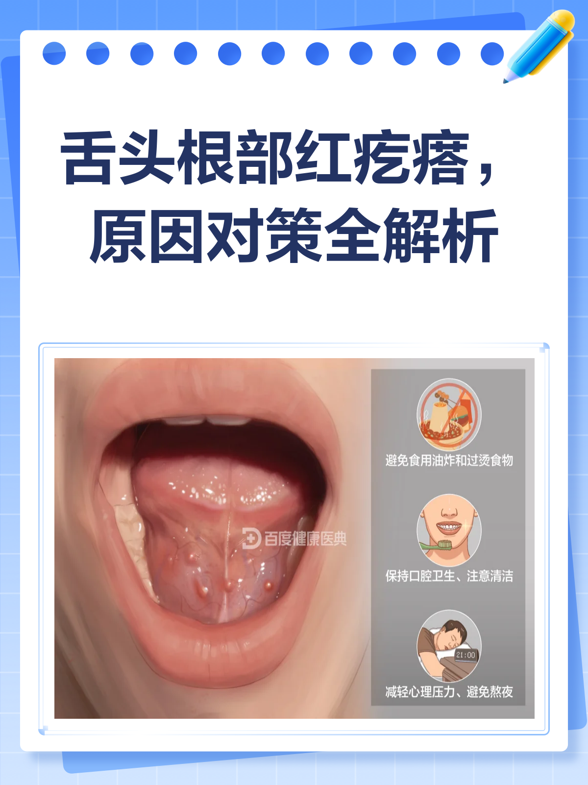 舌头根部红疙瘩凸起？别慌，先看这里！