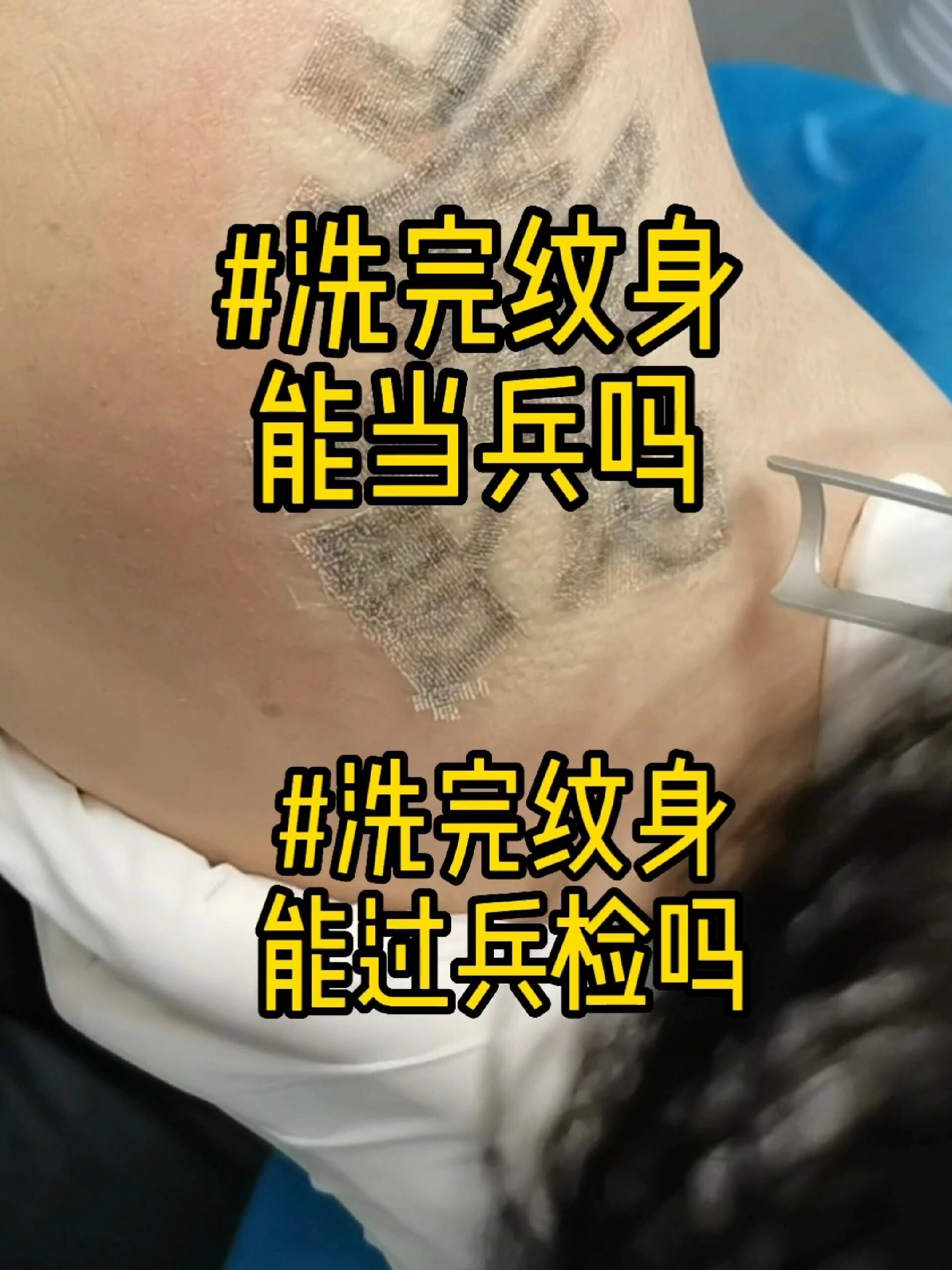 洗完纹身能当兵吗?