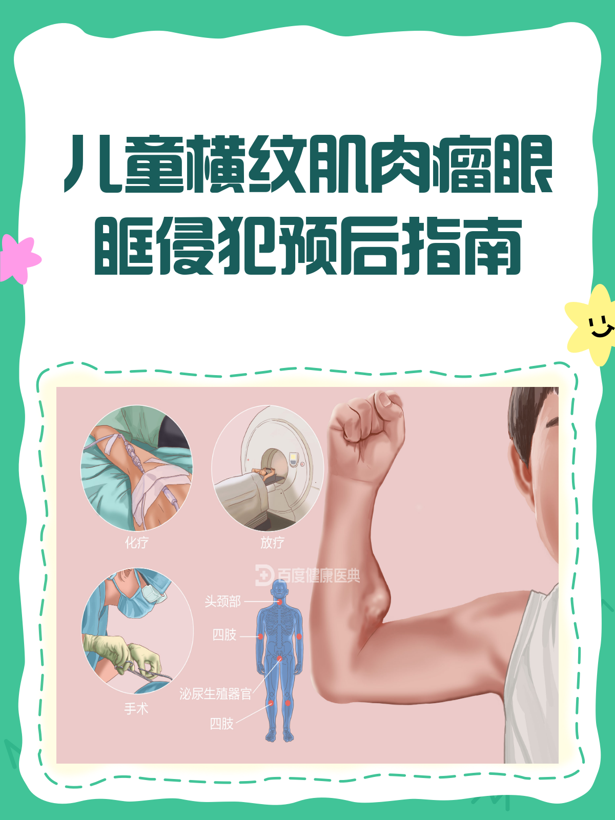 儿童横纹肌肉瘤眼眶侵犯,预后知多少?