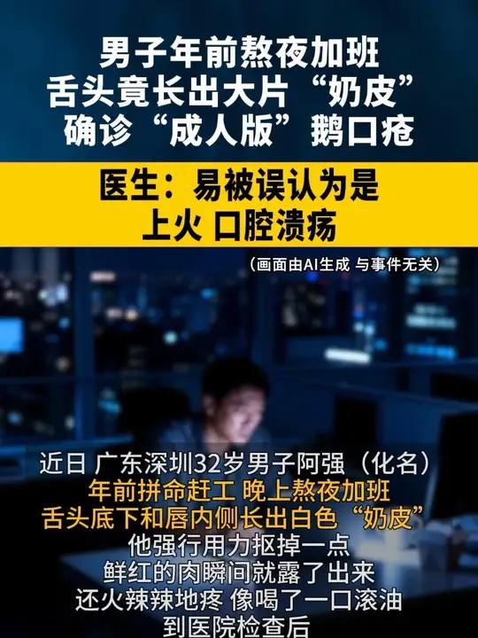 32岁男子年前熬夜加班，舌头竟长出大片“奶皮”，确诊“成人版”鹅口疮。医生：易被误认为是上