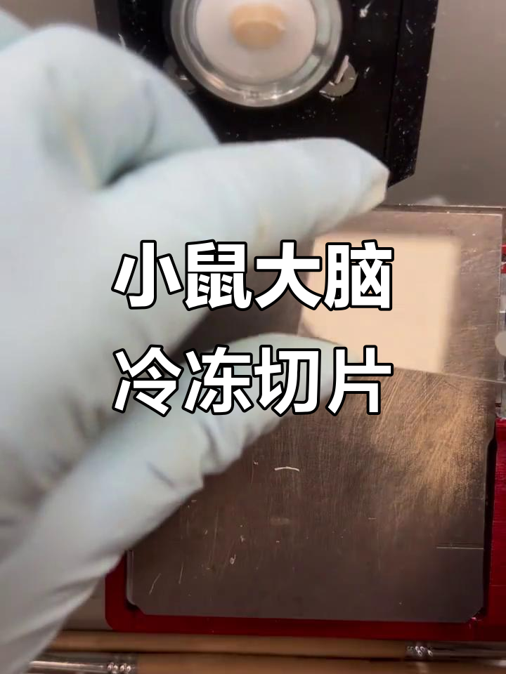 成年小鼠脑冰冻切片全流程解析