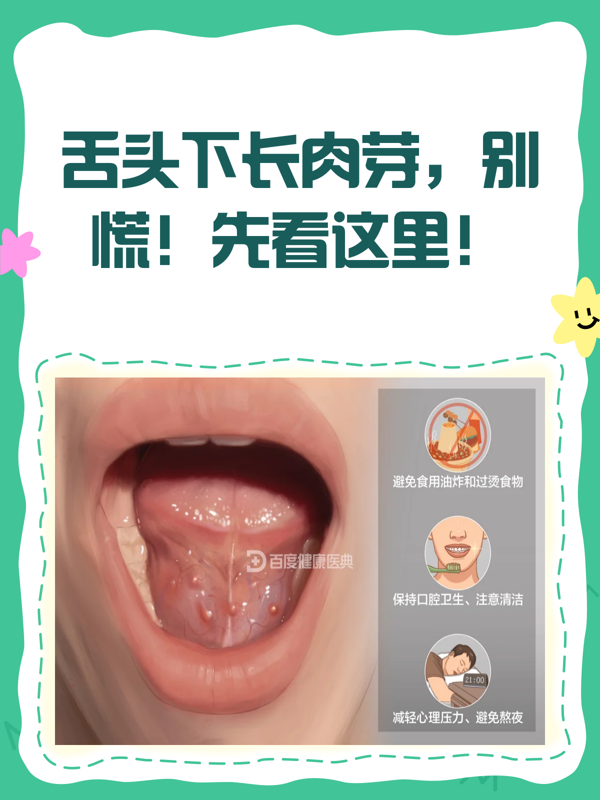 舌头下长小肉芽？别慌，先来看看这个！