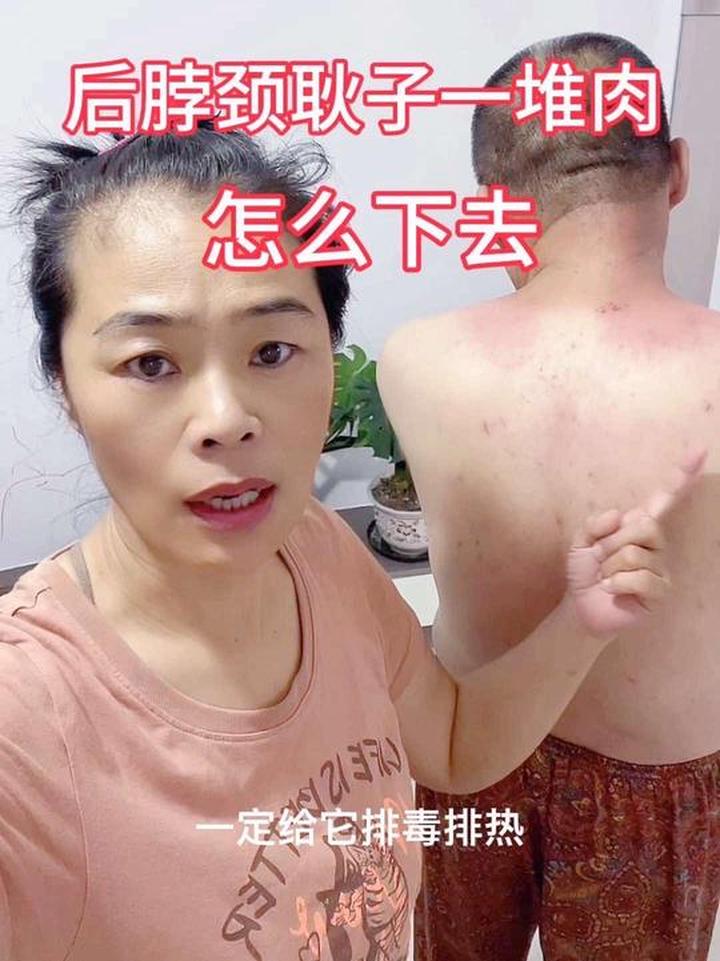 脖子有赘肉、后背厚且肚子大的朋友来看看