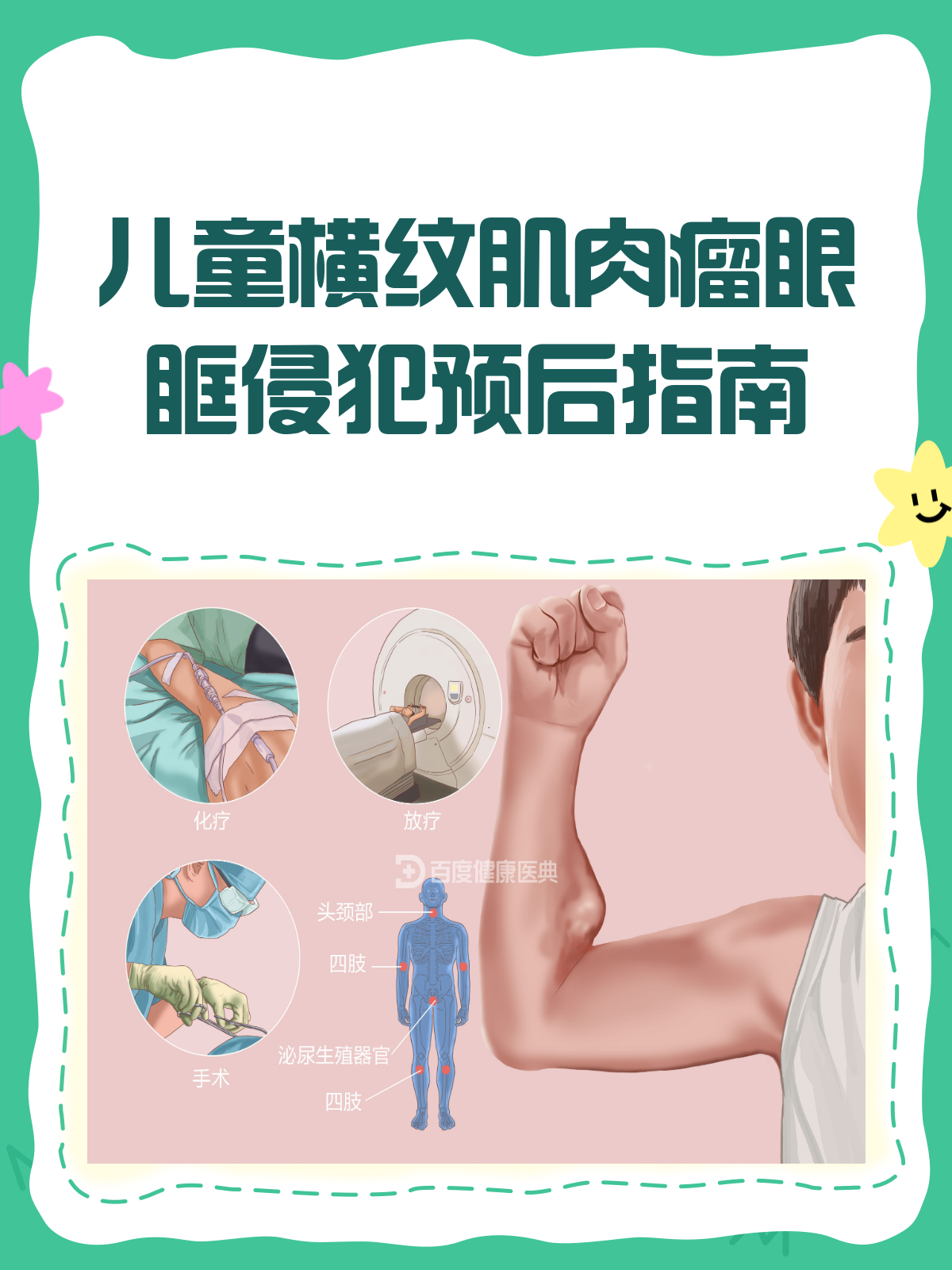 儿童横纹肌肉瘤眼眶侵犯,预后知多少?