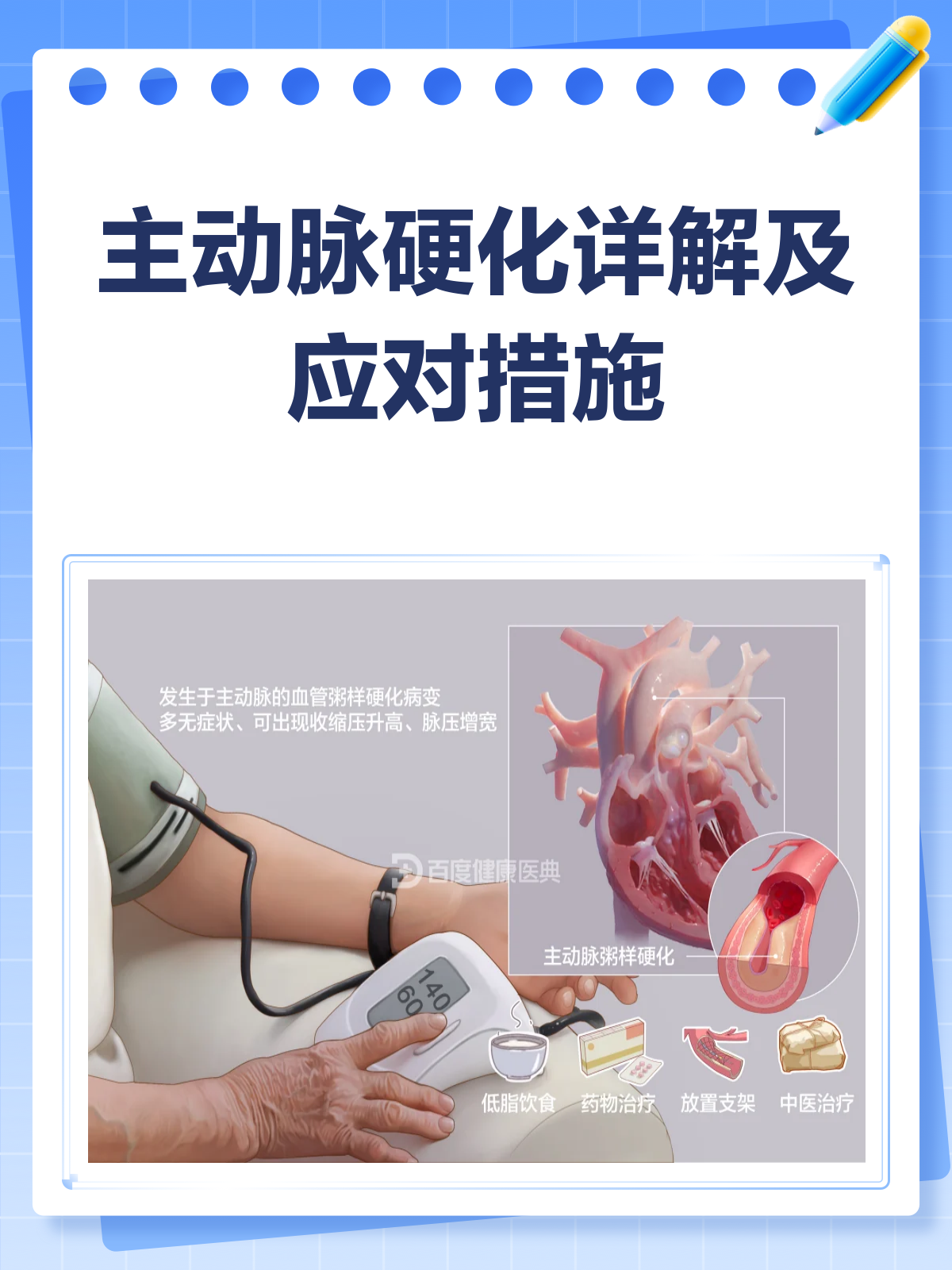 主动脉硬化,你真的了解吗?