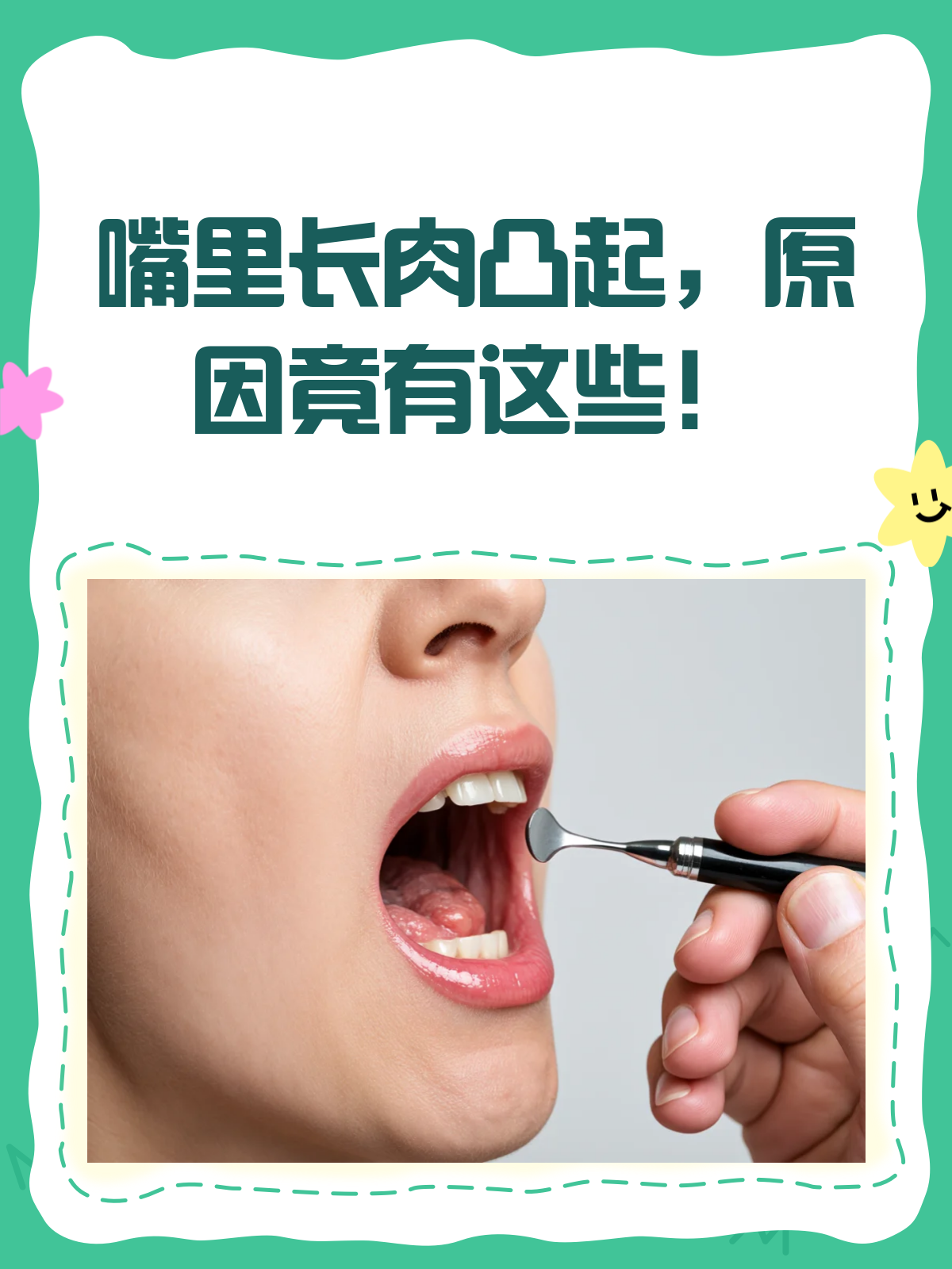 嘴里长了个肉凸起?别急,先看看这个!