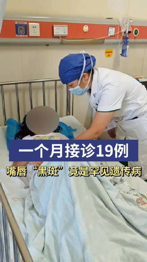 「一个月接诊了19例,女孩嘴唇长黑斑竟是罕见病」8月8日,9岁的邓可可(化名)躺在湖南省儿