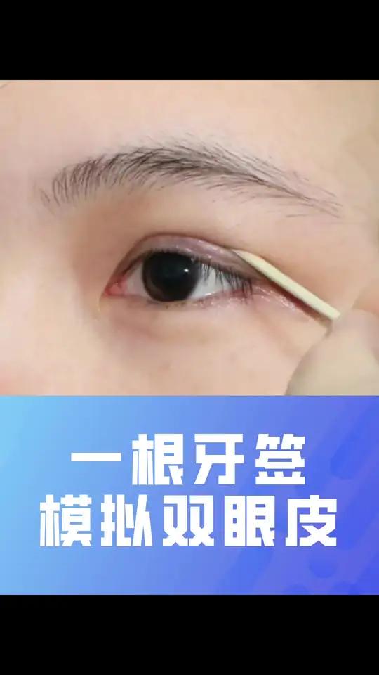 牙签也可以模拟双眼皮形态,现场操作一下